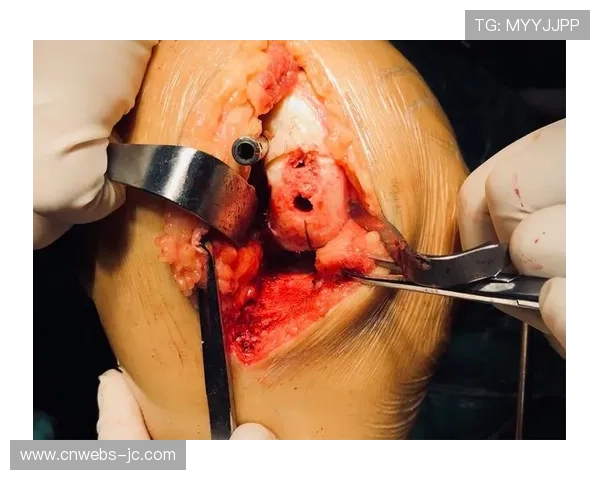 运动医学机构发布自行车手膝关节保护指南，建议功率峰值控制在8.5W-kg内